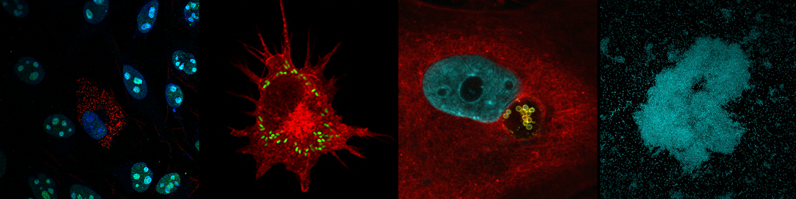 Selection of confocal immunofluorescence microscopy images. First, on the left, a macrophage infected with Brucella; second, an activated infected dendritic cell; third, an Acinetobacter baumannii-infected epithelial cell; fourth, an aggregate of an environmental Acinetobacter baumannii.