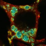 Macrophage infected with Brucella abortus showing large vacuoles that mediate bacterial egress from infected cells.