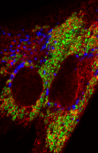 Brucella abortus multiplying inside a human trophoblast.