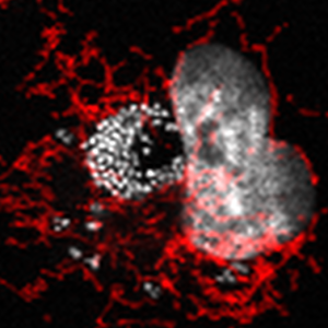 Human endothelial cell infected with Acinetobacter baumannii ABC141 strain. Bacteria can be seen in white, as the nucleus of the cell, thanks to the DNA stain Dapi. The mitochondria are in red. One can see a cluster of bacteria indicative of extensive intracellular multiplication.