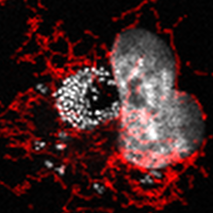 ABC141 A. baumannii and mitochondira (red). Bacteria are visualized by the DAPI (white).